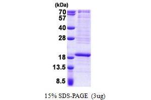 SDS-PAGE (SDS) image for Ribosomal Protein L22 (RPL22) (AA 1-128) protein (His tag) (ABIN5853080)