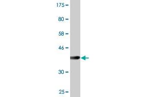 Western Blot detection against Immunogen (37.