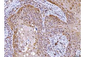 IHC analysis of AHA1/AHSA1 using anti-AHA1/AHSA1 antibody (ABIN7600708). (AHSA1 anticorps  (AA 221-264))