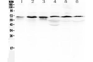 Western blot analysis of TRAF5 using anti-TRAF5 antibody . (TRAF5 anticorps  (AA 277-557))
