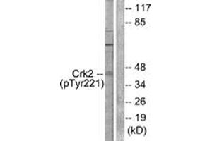 Western blot analysis of extracts from COS7 cells, using CrkII (Phospho-Tyr221) Antibody. (Crk anticorps  (pTyr221))