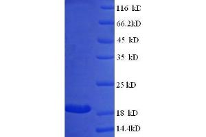 SDS-PAGE (SDS) image for Beta Lactoglobulin (LGB) (full length) protein (ABIN7479571) (Beta Lactoglobulin (LGB) (full length) Protéine)