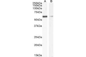 ABIN6391377 (1µg/ml) staining of HEK293 (A) and HeLa (B) cell lysate (35µg protein in RIPA buffer).
