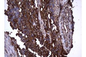 Image no. 7 for anti-Tumor Necrosis Factor Receptor Superfamily, Member 8 (TNFRSF8) (AA 19-379) antibody (ABIN1491084)