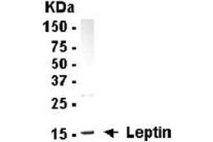 Western Blotting (WB) image for anti-Leptin (LEP) (full length) antibody (ABIN2467855) (Leptin anticorps  (full length))