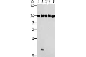 Western Blotting (WB) image for anti-Matrin 3 (MATR3) antibody (ABIN2430421)