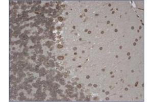 Immunohistochemistry (IHC) image for anti-Transient Receptor Potential Cation Channel, Subfamily M, Member 7 (TRPM7) (AA 1817-1863), (C-Term) antibody (ABIN452417) (TRPM7 anticorps  (C-Term))