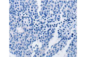 Immunohistochemistry (IHC) image for anti-TNF Receptor-Associated Protein 1 (TRAP1) antibody (ABIN1875197) (TRAP1 anticorps)
