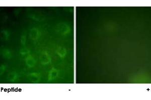 Immunofluorescence analysis of COS-7 cells, using PDGFRB polyclonal antibody . (PDGFRB anticorps)