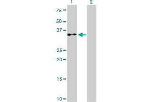 Western Blot analysis of EIF2S1 expression in transfected 293T cell line by EIF2S1 monoclonal antibody (M01), clone 3H12-C11.