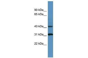 Western Blot showing Ctsd antibody used at a concentration of 1-2 ug/ml to detect its target protein. (Cathepsin D anticorps  (C-Term))