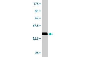 Western Blot detection against Immunogen (36. (ALAS2 anticorps  (AA 1-100))