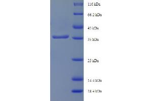 SDS-PAGE (SDS) image for Intraflagellar Transport 27 Homolog (IFT27) (AA 1-186), (full length) protein (His-SUMO Tag) (ABIN5711847)