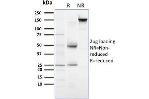 SDS-PAGE Analysis Purified PLK1 Mouse Monoclonal Antibody (AZ44). (PLK1.S anticorps)