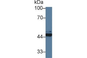 Detection of FKBPL in Human Hela cell lysate using Polyclonal Antibody to FK506 Binding Protein Like Protein (FKBPL)