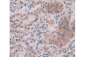 Used in DAB staining on fromalin fixed paraffin- embedded stomach tissue (PPP1CA anticorps  (AA 2-330))