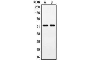 Western blot analysis of PPHLN1 expression in A549 (A), COLO205 (B) whole cell lysates. (PPHLN1 anticorps  (Center))