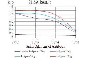 Black line: Control Antigen (100 ng), Purple line: Antigen(10 ng), Blue line: Antigen (50 ng), Red line: Antigen (100 ng),