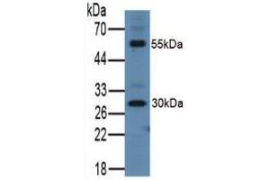 Western blot analysis of Mouse Lung Tissue. (ITLN1/Omentin anticorps  (AA 31-253))