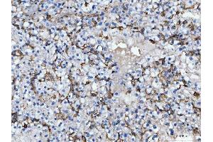 IHC analysis of CD14 using anti-CD14 antibody (ABIN7600531).