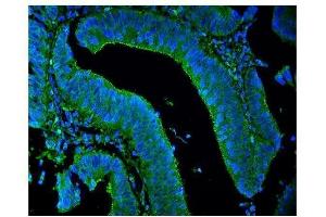 IF analysis of LPP using anti-LPP antibody (ABIN7602831).