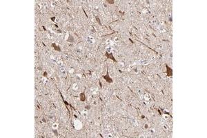 Immunohistochemical staining of human cerebral cortex with GLDC polyclonal antibody  shows strong cytoplasmic positivity in neuronal cells. (GLDC anticorps)