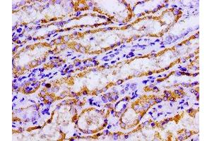 Immunohistochemistry of paraffin-embedded human kidney tissue using ABIN7143021 at dilution of 1:100 (ACO2 anticorps  (AA 452-676))