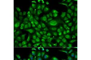 Immunofluorescence analysis of U2OS cells using HSPA1L Polyclonal Antibody (HSPA1L anticorps)