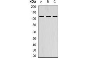 Western blot analysis of AARS2 expression in HepG2 (A), SKOV3 (B), MCF7 (C) whole cell lysates. (AARS2 anticorps)