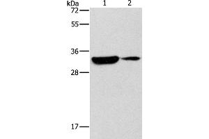 Western Blot analysis of Mouse heart and brain tissue using DSCR1 Polyclonal Antibody at dilution of 1:500 (RCAN1 anticorps)
