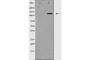 Western blot analysis of ZEB2 expression in HepG2 cell lysate,The lane on the left is treated with the antigen-specific peptide. (ZEB2 anticorps  (N-Term))