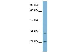 HSD17B14 antibody used at 1 ug/ml to detect target protein. (HSD17B14 anticorps)
