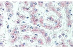 Detection of C5a in Human Liver Tissue using Polyclonal Antibody to Complement Component 5a (C5a)
