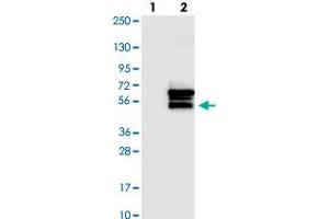Western blot analysis of Lane 1: Negative control (vector only transfected HEK293T lysate). (OSBPL2 anticorps)