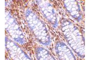 Immunohistochemistry of HTRA2 in human colon tissue with HTRA2 polyclonal antibody  at 10 ug/mL .