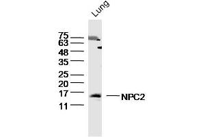 Mouse Lung lysates probed with NPC2 Polyclonal Antibody, Unconjugated  at 1:300 dilution and 4˚C overnight incubation.