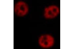 ABIN6266711 staining Hela by IF/ICC. (AKAP8 anticorps  (Internal Region))