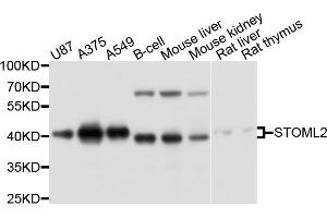 Western blot analysis of extracts of various cell lines, using STOML2 antibody. (STOML2 anticorps)