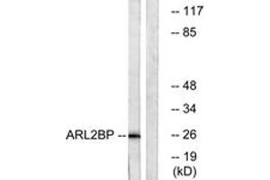 Western blot analysis of extracts from A549 cells, using ARL2BP Antibody. (ARL2BP anticorps  (AA 101-150))