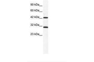 Image no. 1 for anti-DEAD (Asp-Glu-Ala-Asp) Box Polypeptide 39A (DDX39) (N-Term) antibody (ABIN203128) (DDX39 anticorps  (N-Term))