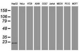 Image no. 2 for anti-Adenylate Kinase 1 (AK1) antibody (ABIN1496517) (Adenylate Kinase 1 anticorps)