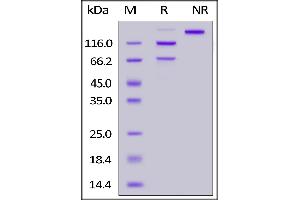 Human Complement C5 (R885H), His Tag on  under reducing (R) and ing (NR) conditions.