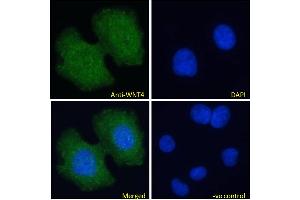ABIN184715 Immunofluorescence analysis of paraformaldehyde fixed MCF7 cells, permeabilized with 0.
