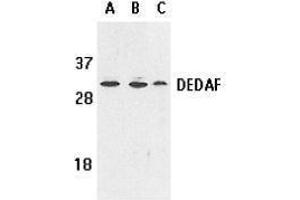 Western Blotting (WB) image for anti-RING1 and YY1 Binding Protein (RYBP) (AA 215-228) antibody (ABIN2473292) (RYBP anticorps  (AA 215-228))