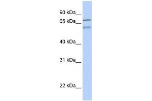 WB Suggested Anti-ZNF671 Antibody Titration:  0. (ZNF671 anticorps  (N-Term))