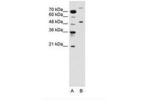 Image no. 1 for anti-Tripartite Motif Containing 42 (TRIM42) (AA 601-650) antibody (ABIN6736653) (TRIM42 anticorps  (AA 601-650))