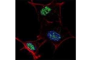 Fluorescent confocal image of SY5Y cells stained with KLF4 antibody at 1:100. (KLF4 anticorps  (AA 481-504))