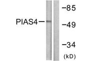 Western blot analysis of extracts from Jurkat cells, using PIAS4 Antibody. (PIAS4 anticorps  (AA 451-500))