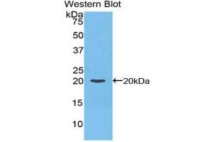 Western blot analysis of the recombinant protein. (Prothrombin anticorps  (AA 44-200))