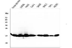Western blot analysis of Cyclophilin B using anti-Cyclophilin B antibody (ABIN6719475).